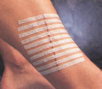 3M Steri-Strip Adhesive Skin Closures (Reinforced)